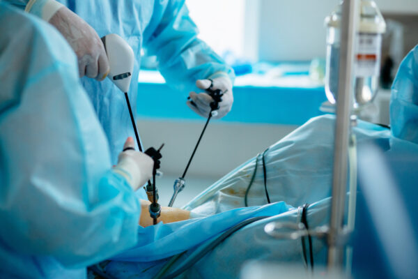 laparoskopska operacija raka prostate