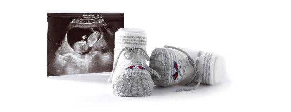 slika ultrazvoka ploda, poleg pa majhni otroški copatki