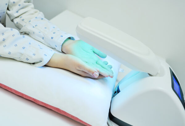 psoriaza ali luskavica rok na fototerapiji z UV svetlobo